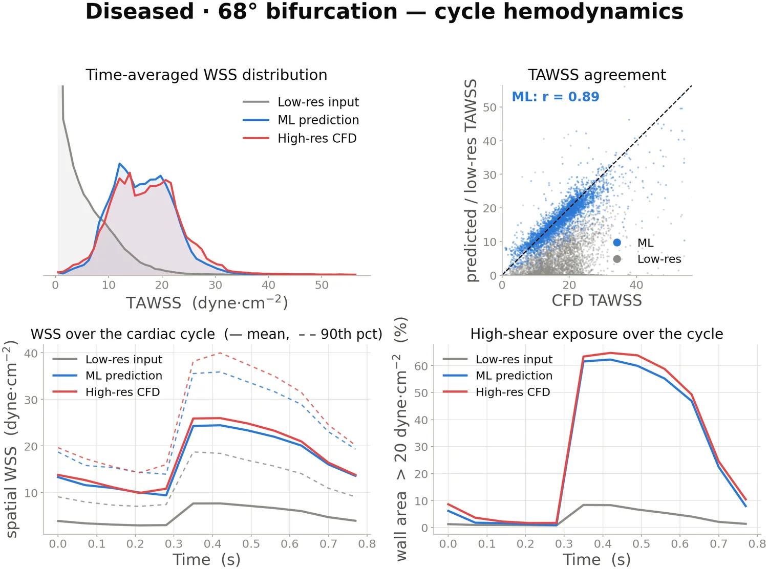 Four panels: time-averaged WSS distribution, TAWSS agreement scatter, spatial WSS over the cardiac cycle, and percentage of wall area above 20 dyne per square centimetre, each comparing low-resolution input, ML prediction and high-resolution CFD.