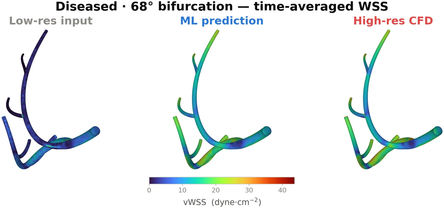 Three renders of the same diseased coronary artery tree coloured by time-averaged wall shear stress. The low-resolution input is almost uniformly dark blue; the ML prediction and the high-resolution CFD reference both show matching green and orange high-shear bands near the stenosis and the bifurcations.